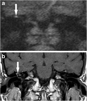 Fig. 10