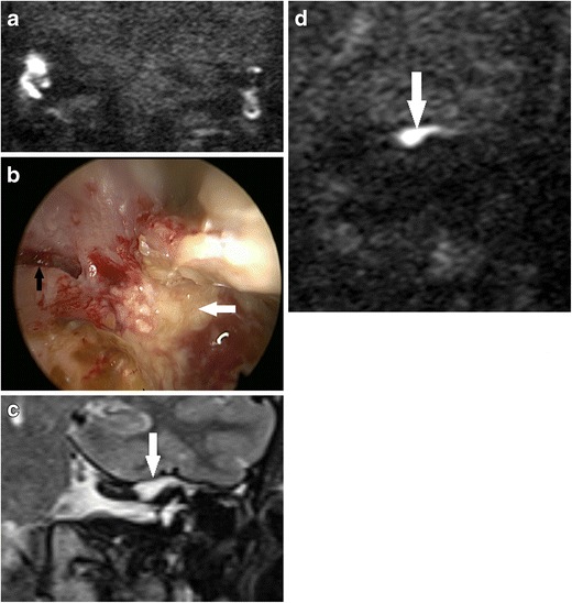 Fig. 13