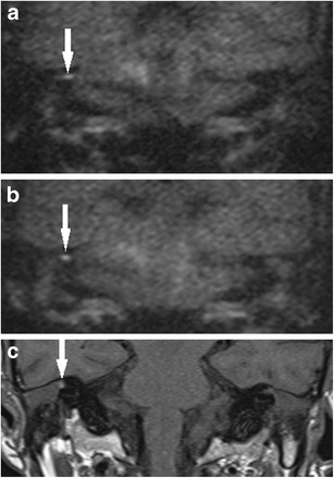 Fig. 8