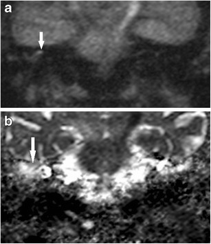 Fig. 9