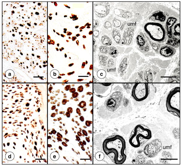 Fig. 11