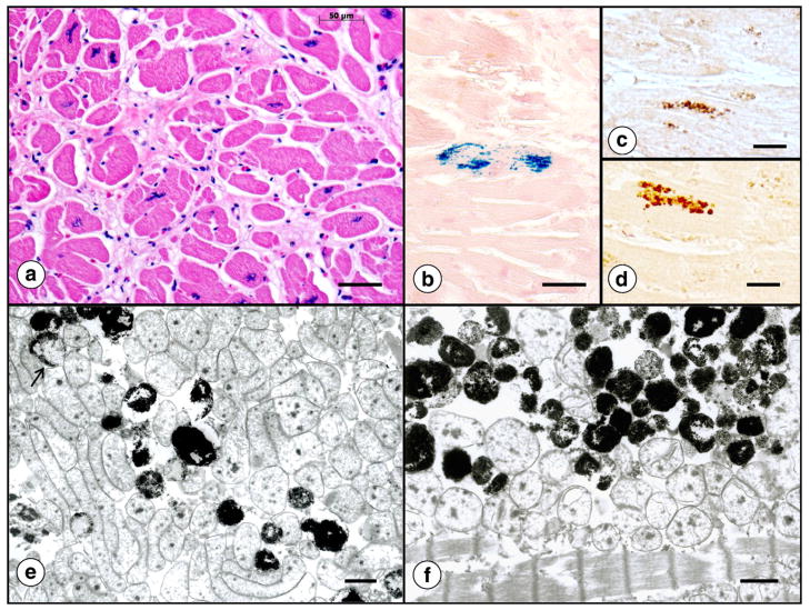 Fig. 12