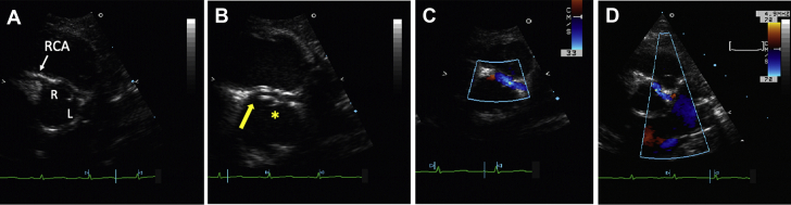 Figure 1