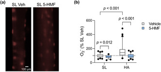 graphic file with name PHY2-11-e15743-g002.jpg