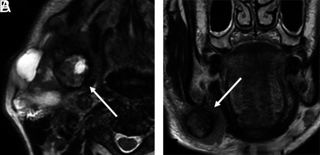 FIG 2.