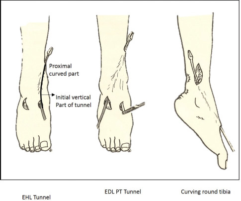 Fig. 12