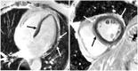 Fig. 12