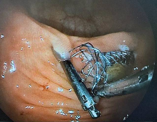 graphic file with name 120_2022_2013_Fig3_HTML.jpg