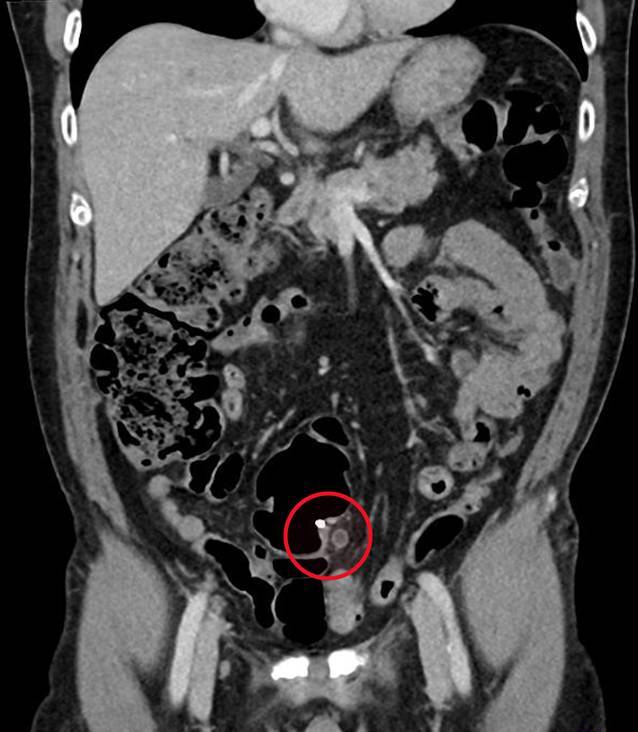 graphic file with name 120_2022_2013_Fig1_HTML.jpg