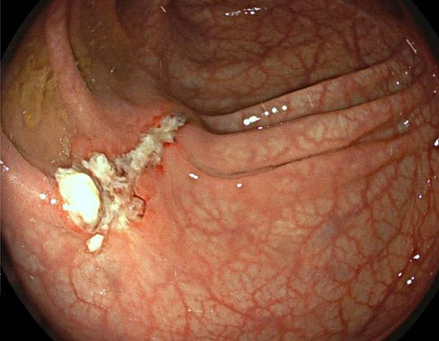 graphic file with name 120_2022_2013_Fig2_HTML.jpg