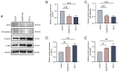 Figure 2. rC6ORF120 induced the EndMT in HUVECs. (A) Representative western blot images of endothelial (CD31 and VE–cadherin) and mesenchymal (Vimentin and α –SMA) marker proteins in HUVECs following ...