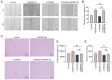 Figure 8. Effect of PI3K / Akt inhibition on rC6ORF120–mediated effects on HUVEC migration and angiogenesis. (A) Effect of rC6ORF120 on the migration of HUVECs after addition of LY294002. (B) Bar grap...