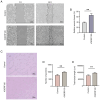 Figure 4. Effects of rC6ORF120 on the migration and angiogenic capacity of HUVECs. (A) Comparison of wound closure between the rC6ORF120–treated group and the control group after a 48–h incubation per...
