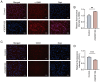 Figure 3. rC6ORF120 alters the fluorescence intensity of EndMT markers. Immunocytofluorescence staining of (A) α –SMA and (C) CD31 in HUVECs following rC6ORF120 treatment, with (B and D) correspondin...
