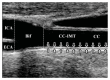 Fig. (1)