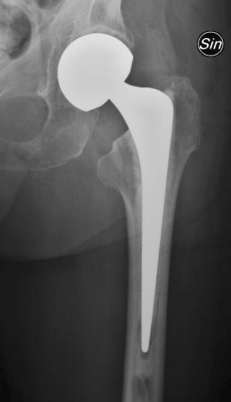 Fig. 1