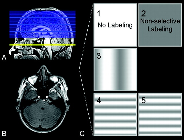 Fig 1.