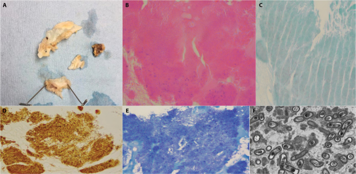 Figure 1: