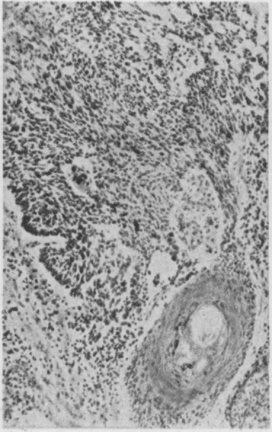 Fig. 14