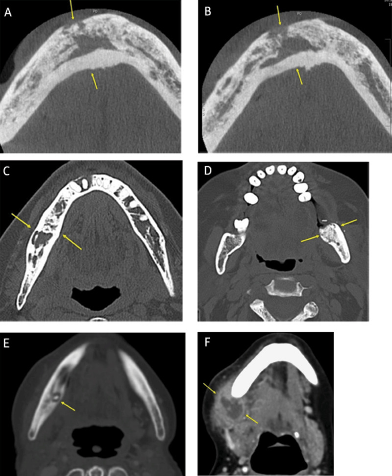 Figure 10