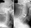 Fig. 2A–B