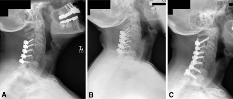 Fig. 3A–C