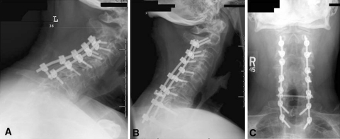 Fig. 1A–C