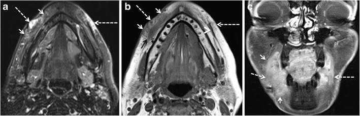 Fig. 9