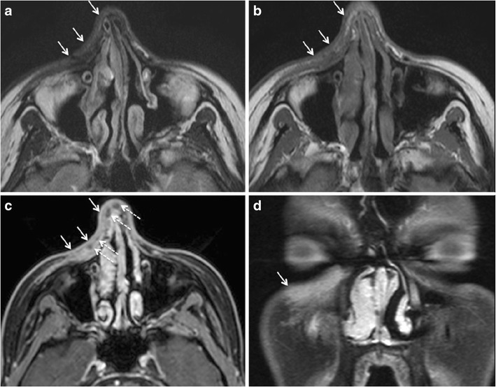 Fig. 12