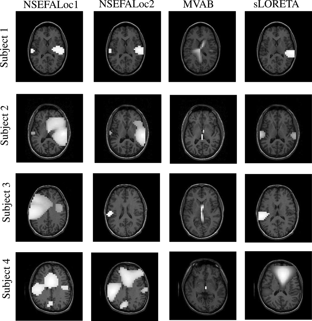 Fig. 11