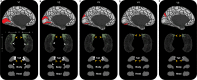 Figure 2—figure supplement 4.