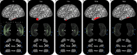 Figure 2—figure supplement 3.