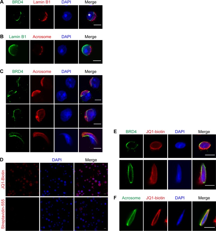 FIG 3