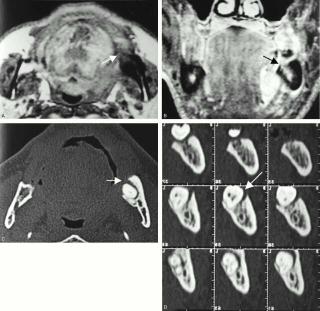 Fig 5.