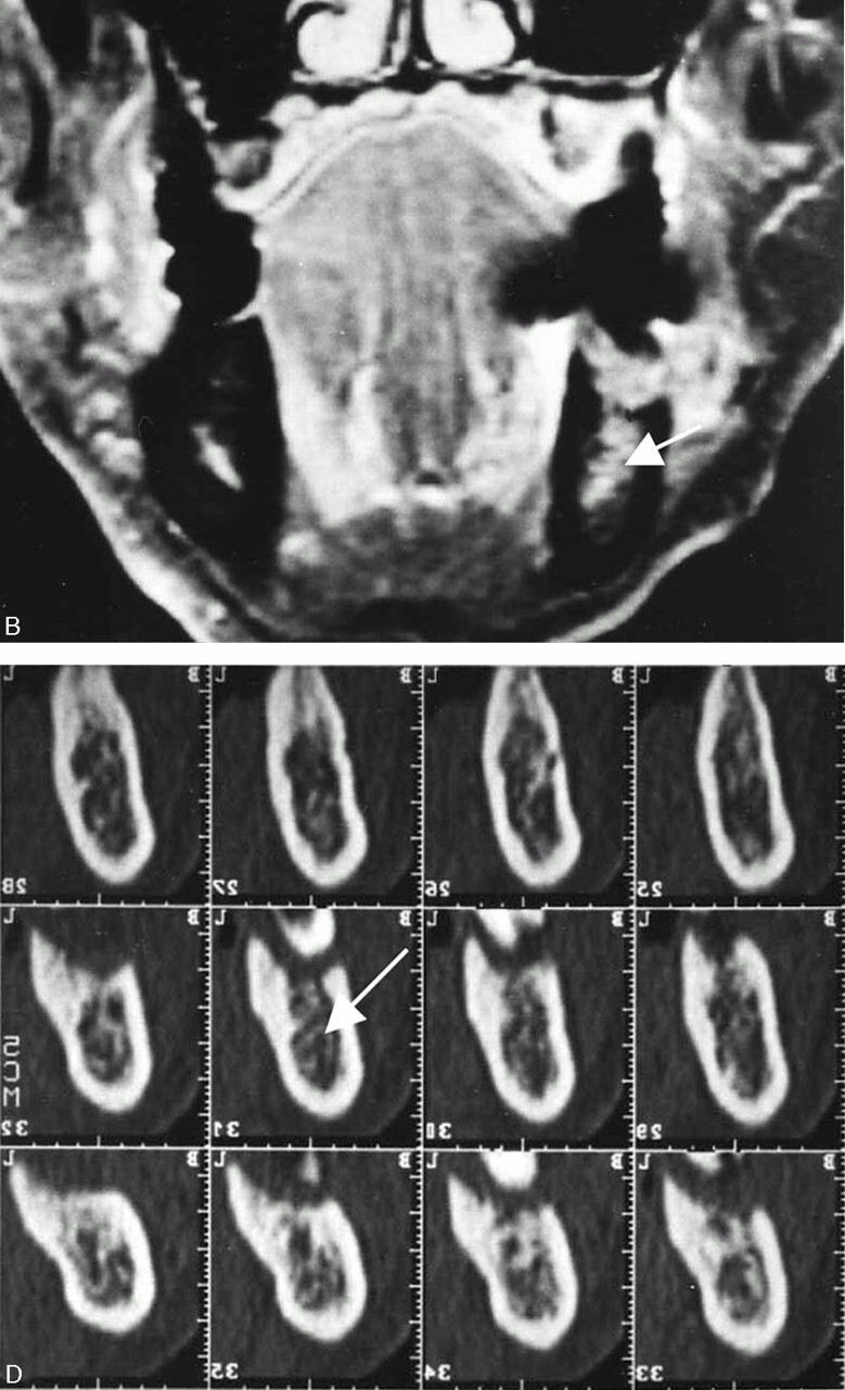 Fig 6.