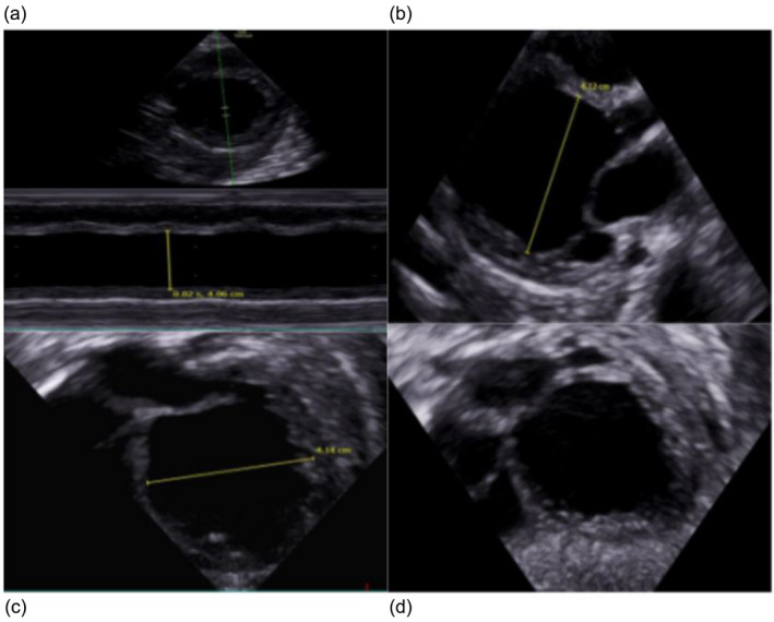 FIGURE 2