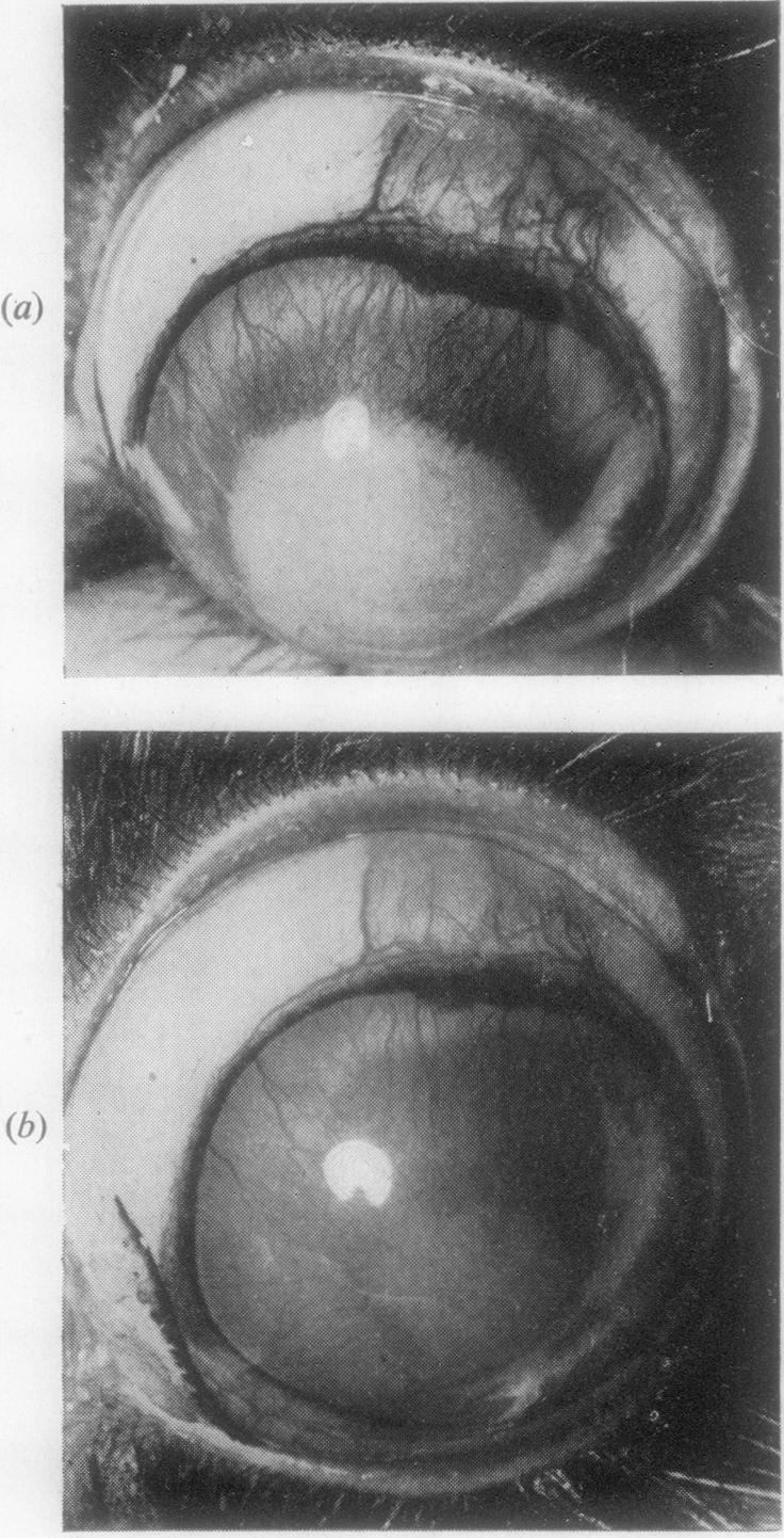 Figs 4(a) and 4(b)