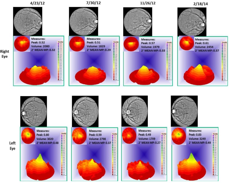 Figure 11
