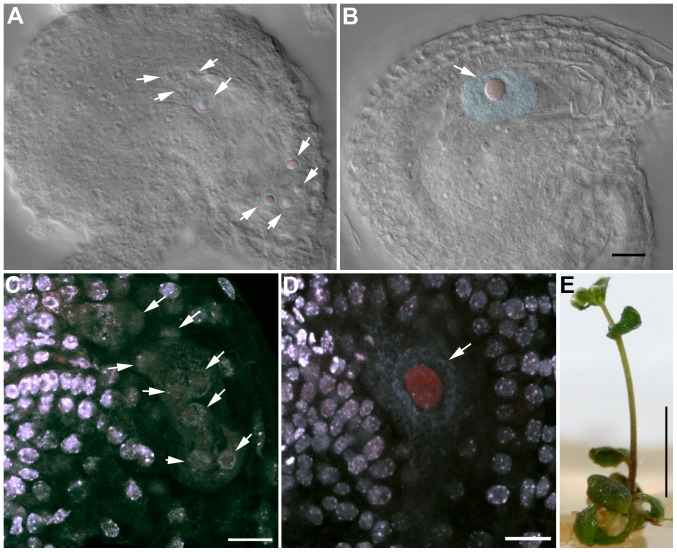 Figure 11