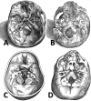 Fig. 3a–d