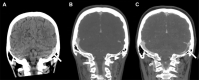 Fig 1 –