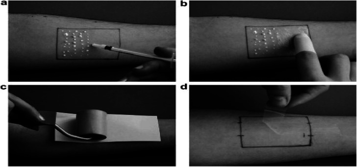 Fig. 17