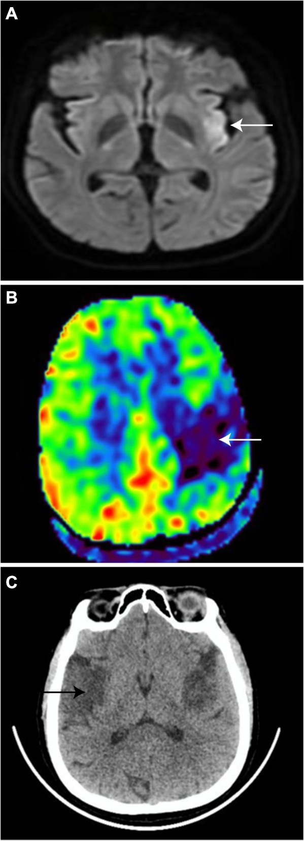 Fig. 1