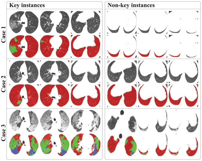 Fig. 10