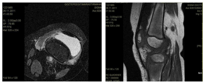 Figure 1, A and B