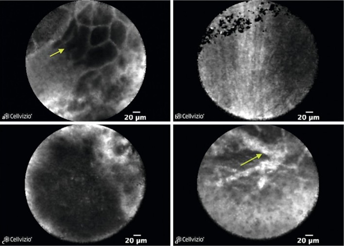 Fig. 6