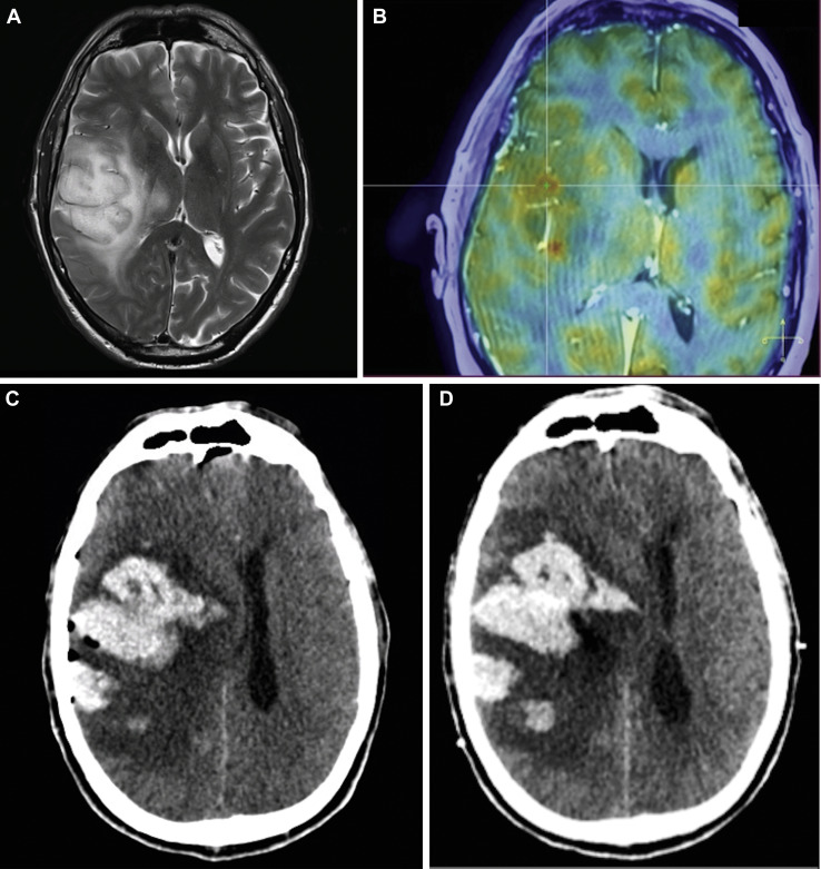 Figure 2