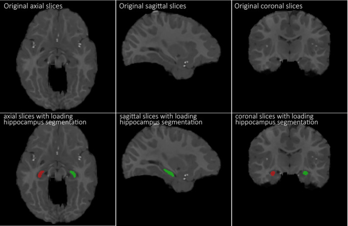 Figure 6