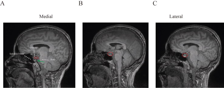 Figure 4.