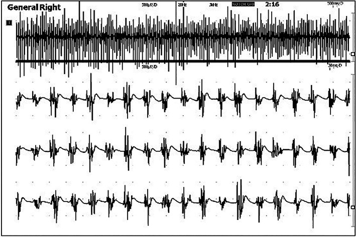 FIGURE 2